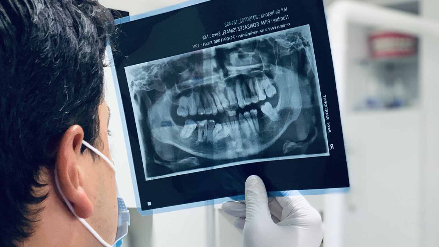 Understanding Dental Veneers: Costs, Types, and Influencing Factors