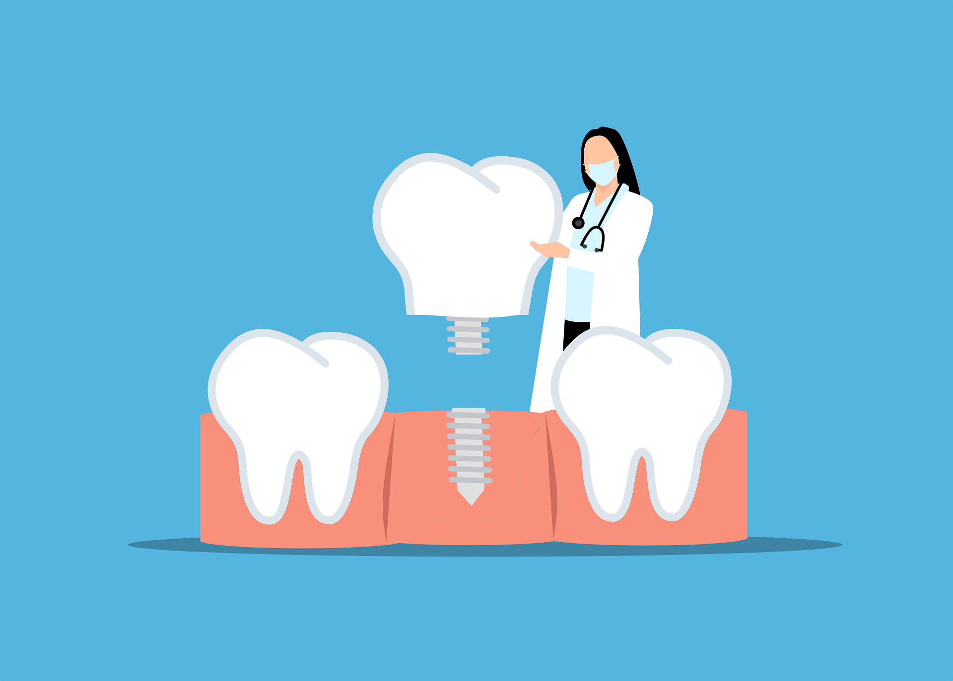 how long do dental implants last